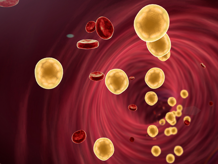 Mikä on korkea kolesteroli ja miten se vaikuttaa terveyteen?